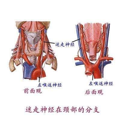 迷走神经损伤