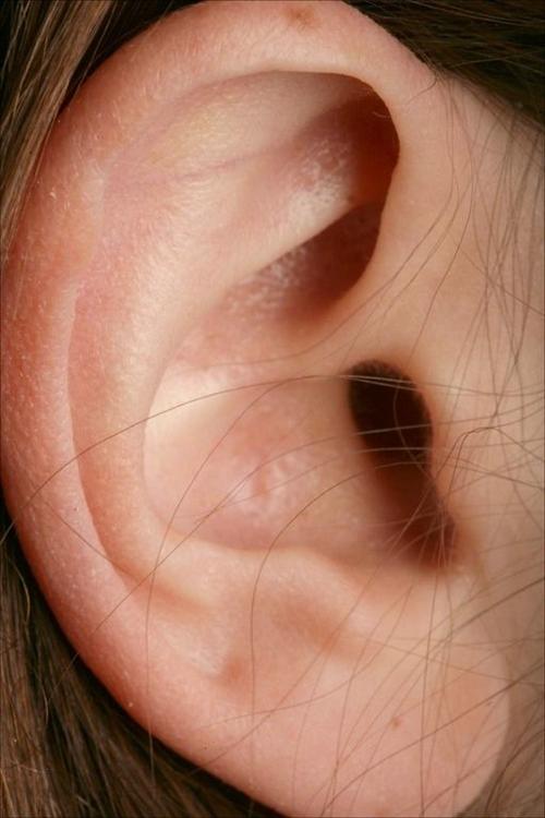 耳带状疱疹