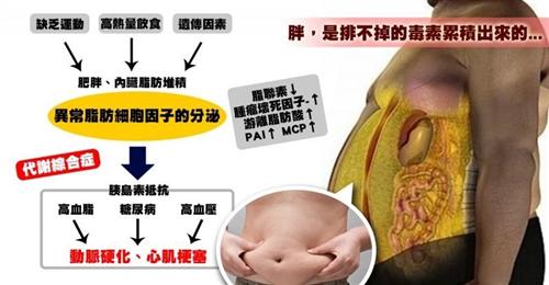 内脏性肥胖