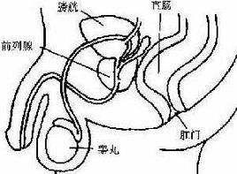 前列腺缩小变硬