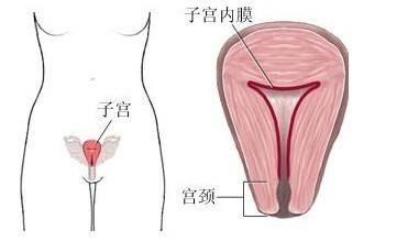 女性生殖器先天性畸形