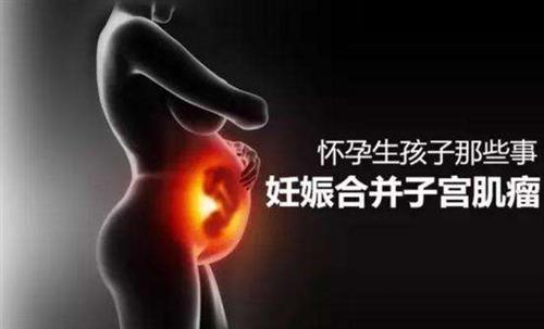 妊娠合并子宫肌瘤