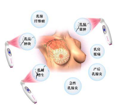 急性化脓性乳腺炎