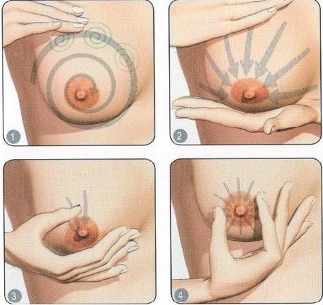 急性化脓性乳腺炎