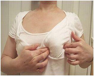 急性化脓性乳腺炎