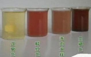 无痛性尿血