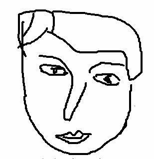 歪鼻