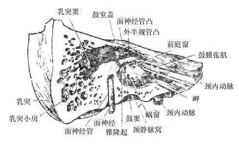特发性面神经瘫痪