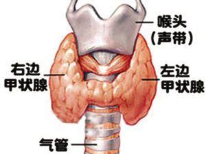 甲状腺微小癌