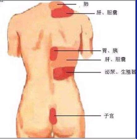 肩部牵涉痛