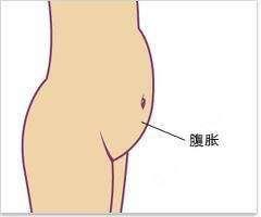 腹部逐渐胀大