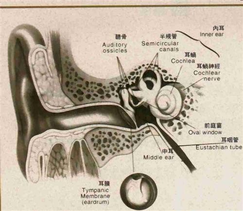 噪声性耳聋