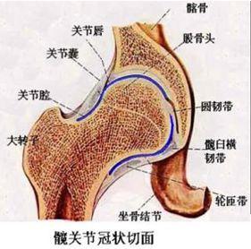 外伤性股骨头坏死
