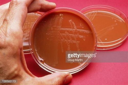 淋菌性肛门直肠炎