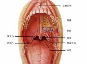 白血病性咽峡炎