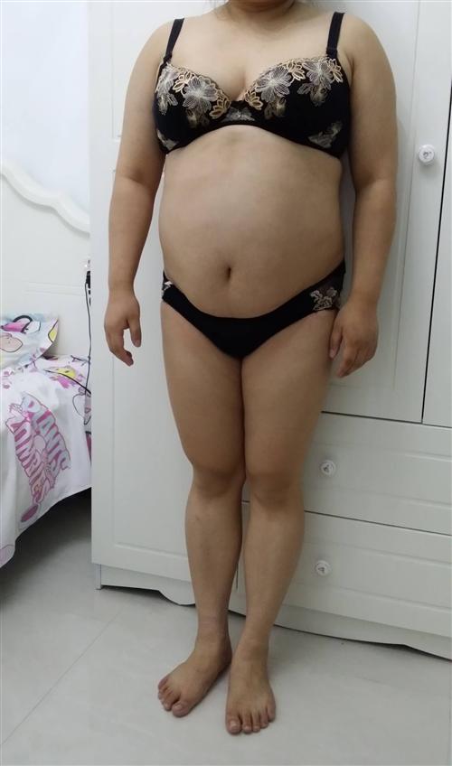 产后肥胖