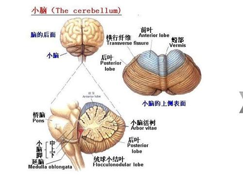 小脑畸形