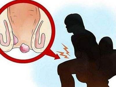 排便感
