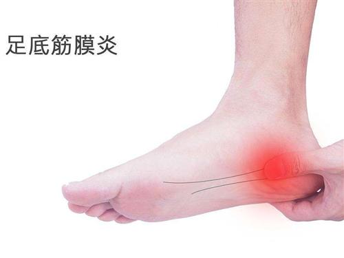 浅筋膜炎