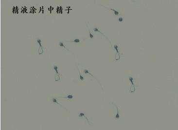 精子存活率低