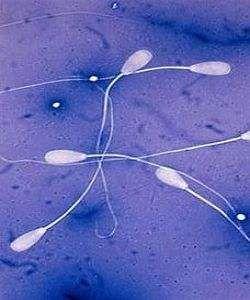精子存活率低