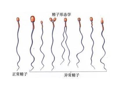 精子存活率低