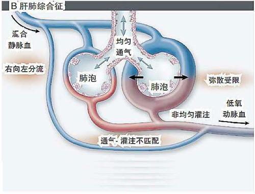 脉氧合不足