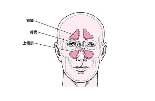 鼻脓涕有臭味