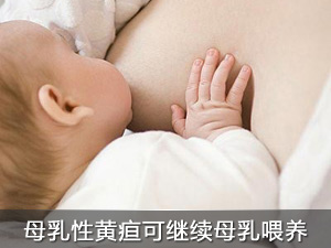 母乳性黄疸可继续母乳喂养
