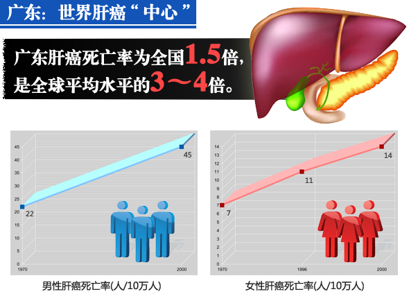 肝癌