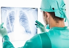 患肺癌为何胸片正常？