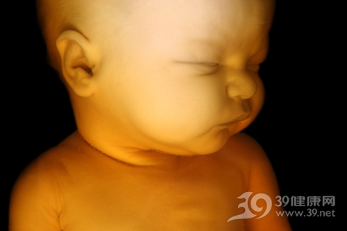 婴儿 胎儿 胚胎 怀孕_1517688_xl