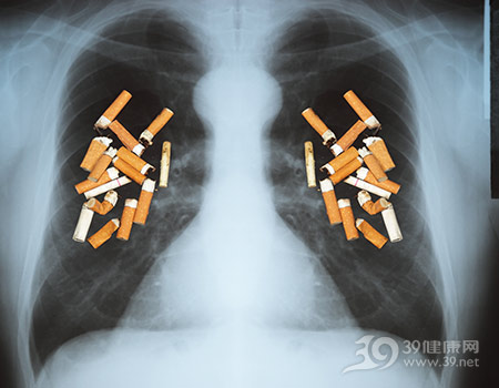 X光片-肺部-抽烟-吸烟-禁烟-无烟日_15688014_xxl