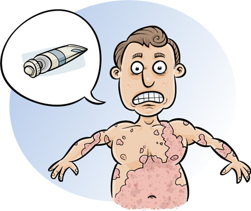 色素性荨麻疹怎么治疗