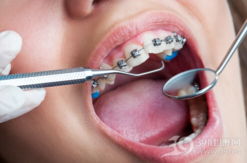 牙齿正畸的危害矫正后牙齿会酸软松动？