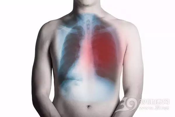 肺癌成我国“第一癌”  得了肺癌还能活多久