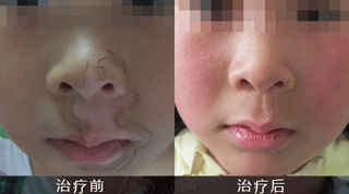 脸部白斑涂抹什么药 org_1032461.gif