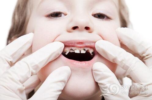 宝宝牙齿有黑斑是长蛀牙了吗？