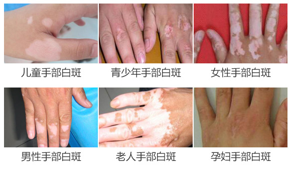 部位