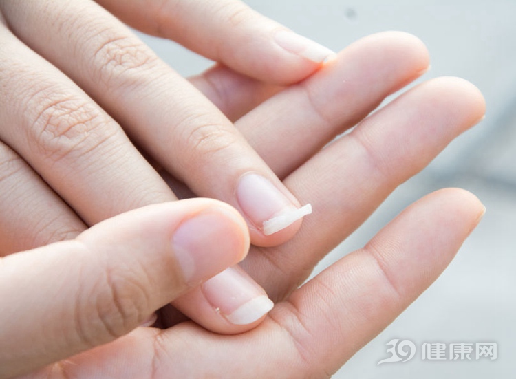 如果指甲易碎,易剥落,可能多和缺钙有关