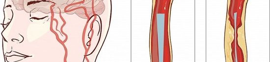 矫正腿部弯曲关节 改变腿型塑美腿