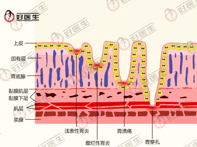 说明:https://mmbiz.qpic.cn/mmbiz_gif/Xh7m8suRo4aRy3RVTLpLrAuXccribgXRu5D8E67zJqIbgTibic5ucg9NfMYsmrZT4YVUm8EIGnjBRqsPibjhc101Kw/640?wx_fmt=gif&tp=webp&wxfrom=5&wx_lazy=1