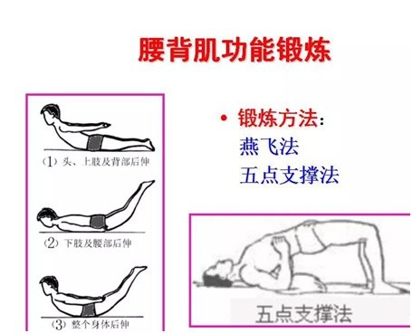 腰痛按按就好？遇到7种情况一定要看医生