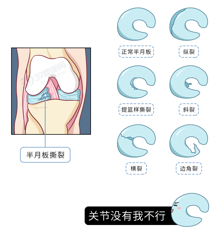 要想膝盖好，滑液不可少！这样运动能分泌滑液，又不伤关节