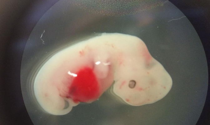 全球首个“人猴混合胚胎”诞生，引发担忧：潘多拉魔盒已被打开？