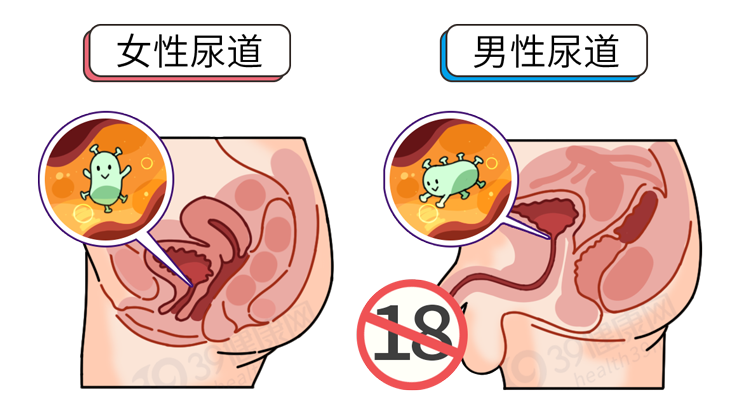 男性尿道大约有18厘米原因1:尿道短,易感染主要有3种原因至于为何女性