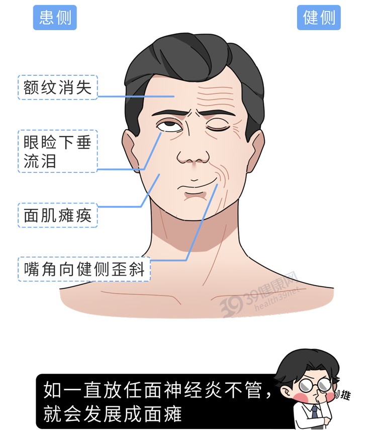 不要小看“睡觉流口水”，若经常发生，可能身体已出现4个问题