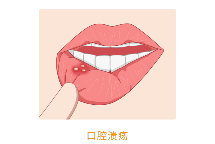 人体缺乏维生素B2,身体3个部位会慢慢“提醒”你,及时补充