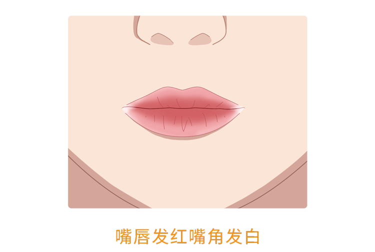 人体缺乏维生素B2,身体3个部位会慢慢“提醒”你,及时补充