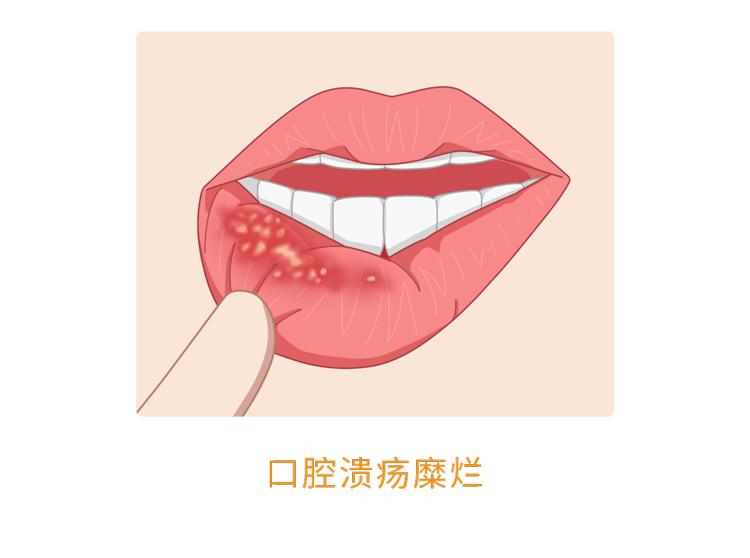 人体缺乏维生素B2,身体3个部位会慢慢“提醒”你,及时补充